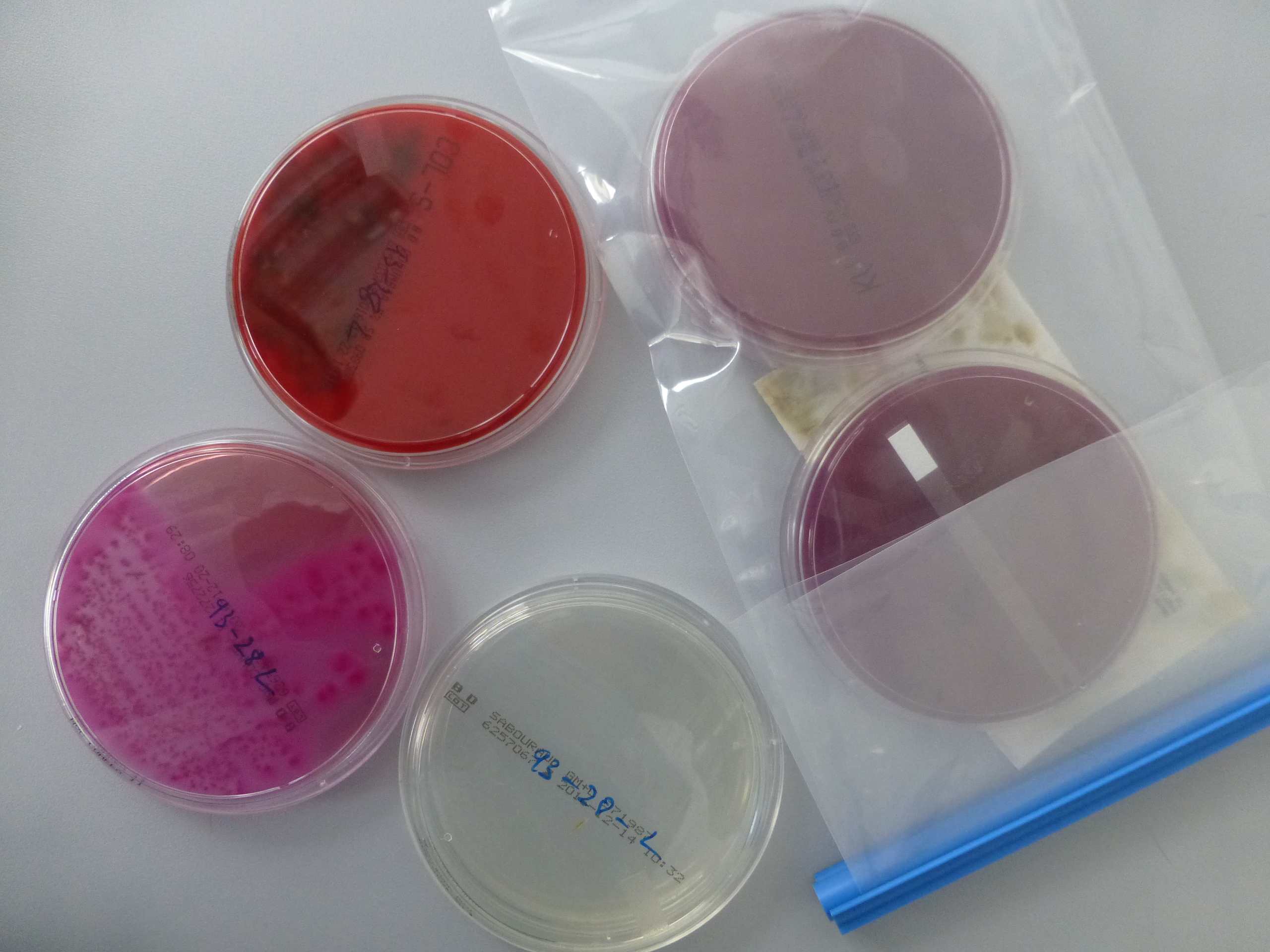 Lawsonia intracellularis - der Erreger der Proliferativen Enteropathie